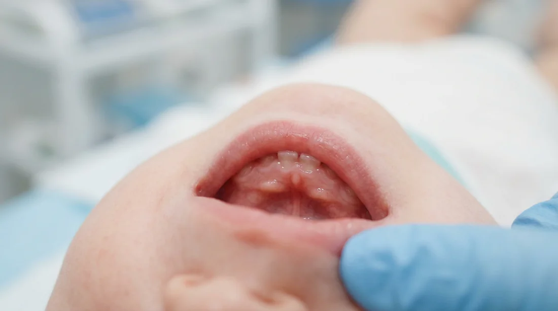 Gencives de bébé en gros plan
